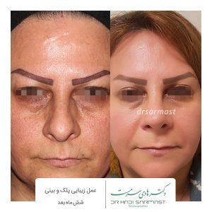 نمونه کار دکتر هادی سرمست